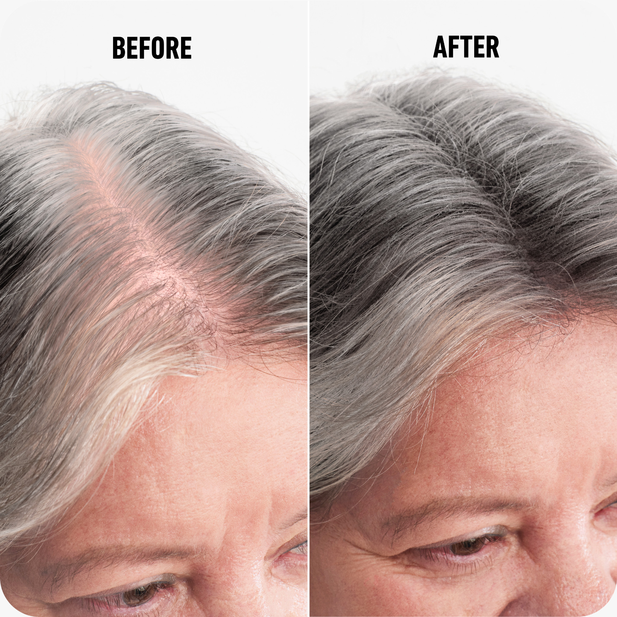 Boldify Hair Fibers Dark Grey 28g
