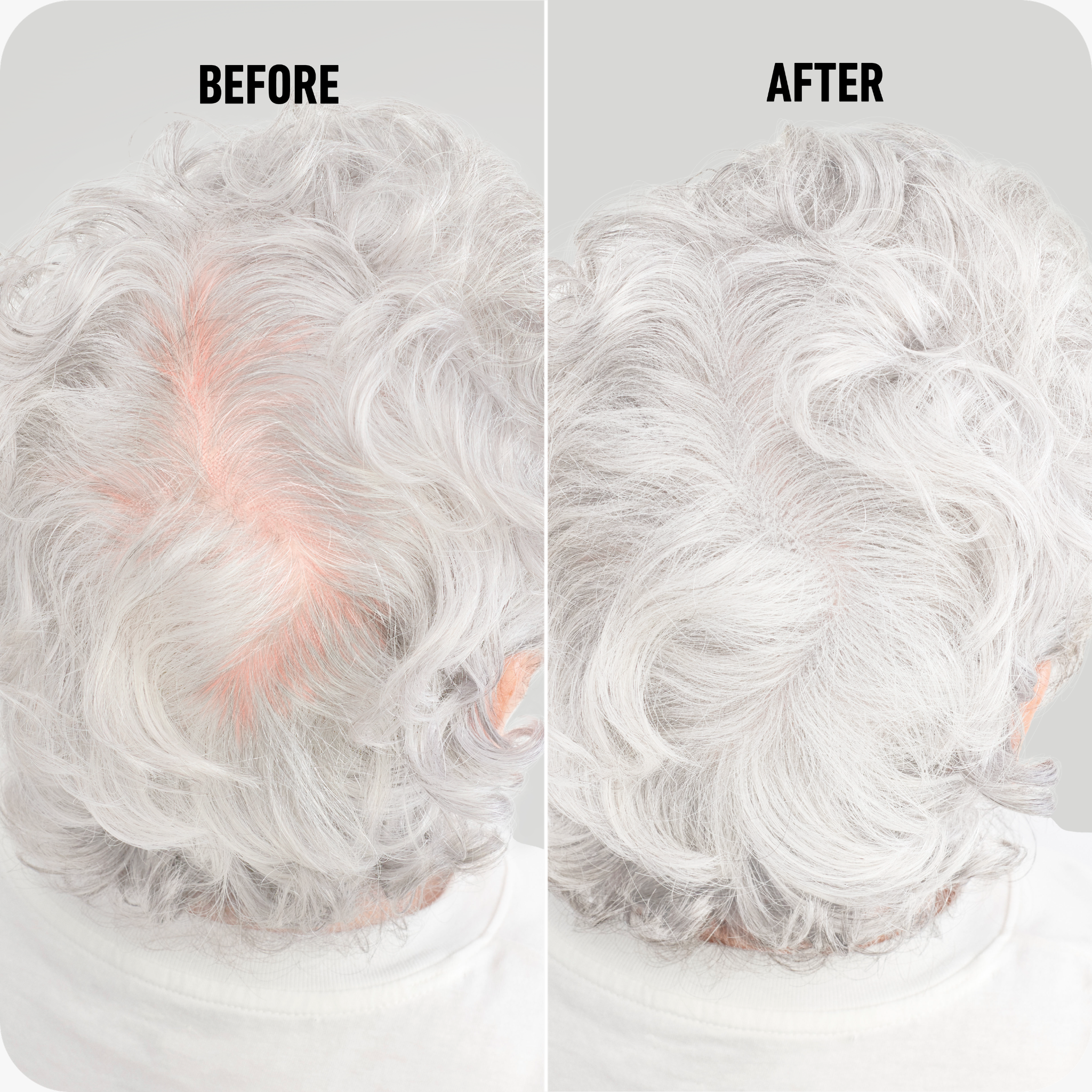 Boldify Hair Fibers White 28g